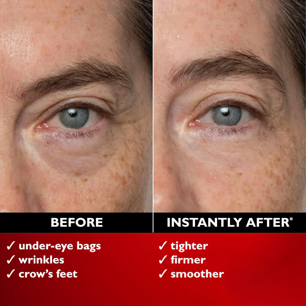 Final 3 Hours 60%OFF:Triple Power Eye Bag instant Erase